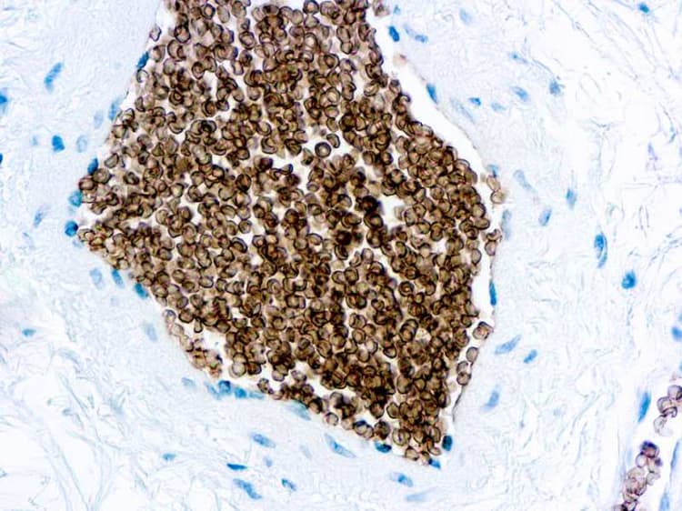 Anti-Glycophorin C/GPC antibody [Ret40f](ab9521)