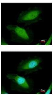 Ddx19b Antibody Ab151478  Immunocytochemistry Immunofluorescence Img96763