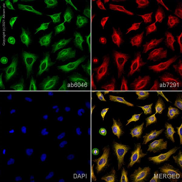 Anti-beta Tubulin antibody - Loading Control(AB6046)