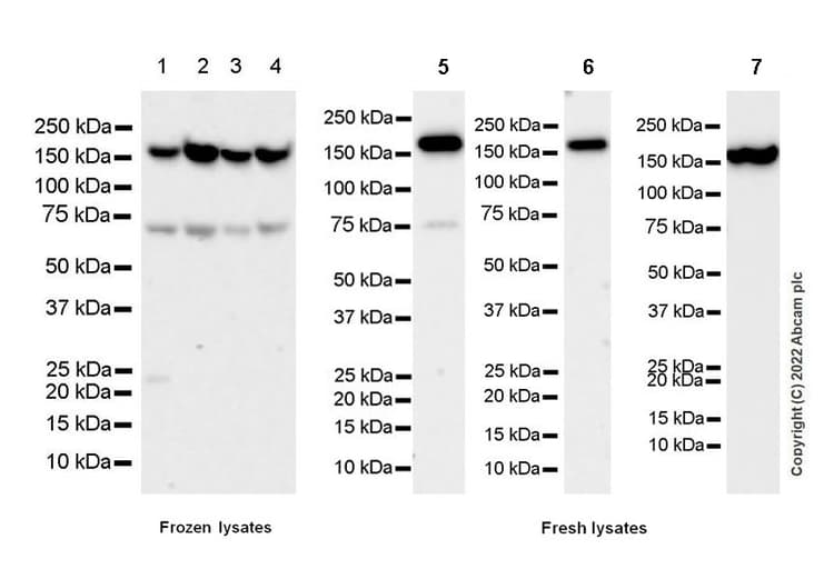 Anti-Collagen III antibody [EPR17673](AB184993)