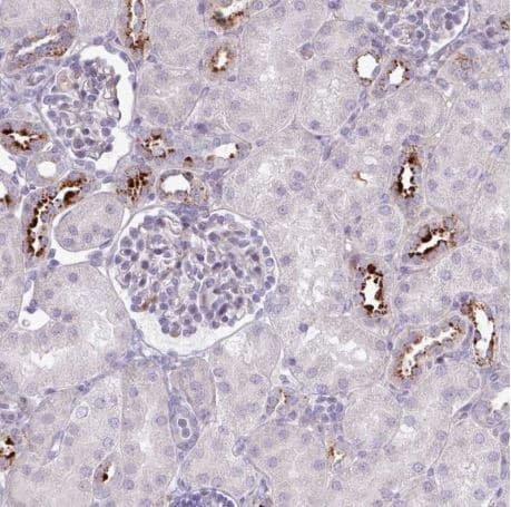 Map7d2 Antibody Ab151140  Immunohistochemistry Formalin Pfa Fixed Paraffin Embedded Sections Img118098