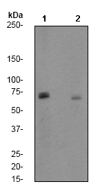 Synapsin I Phospho S9 Antibody Ep2162y Ab76260  Western Blot Img137362