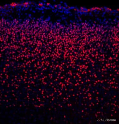 Anti-SATB2 antibody [EPNCIR130A] - BSA and Azide free(AB212177)