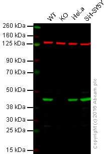 Creatine Kinase B Type Antibody Epr3926 Ab108388  Western Blot Img9044