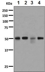 Cytochrome P450 4a Cyp4a11 Antibody Epr8276 Bsa And Azide Free Ab248918  Western Blot Img71179