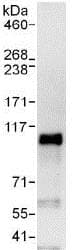 Sox6 Antibody Ab125196  Immunoprecipitation Img83251