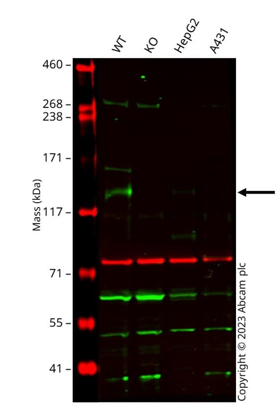Anti-LDL Receptor antibody [EP1553Y] - BSA and Azide free(AB271846)