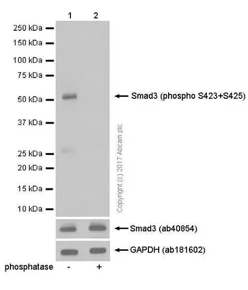 Anti-SMAD3 (pS423/425) + SMAD5 (pS463/465 ) + SMAD1 (pS463/465) + SMAD2 (pS465/467) antibody [EP823Y](AB52903)