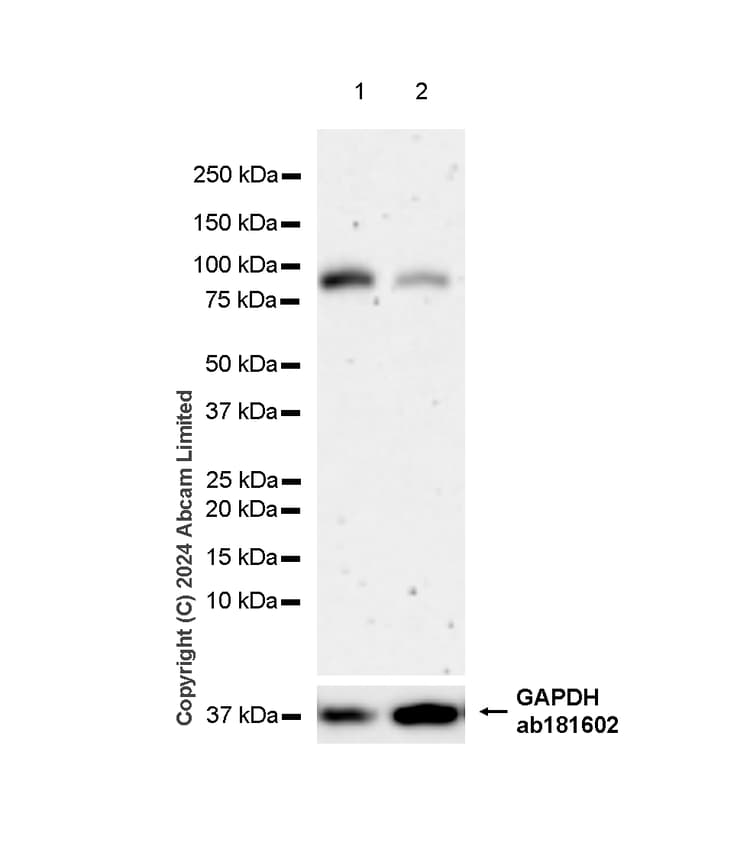 Alkaline Phosphatase Antibody Epr20428 147 Bsa And Azide Free Capture Ab252581  Western Blot Img440866