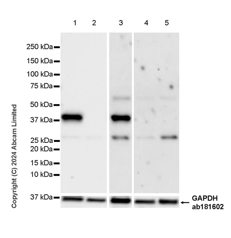 Ykl 40 Chi3l1 Antibody Rm1204 Bsa And Azide Free Ab319165  Western Blot Img434127