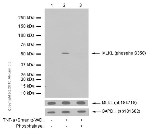 Anti-MLKL (phospho S358) antibody [EPR9514](AB187091)