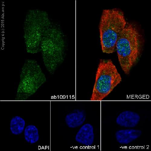Anti-Huntingtin antibody [EPR5526](AB109115)