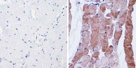 Anti-nNOS (neuronal) antibody(AB5586)