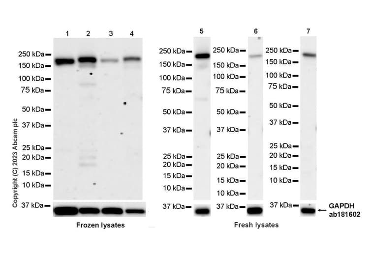 Fyco1 Antibody Epr28361 79 Bsa And Azide Free Ab316013  Western Blot Img426076