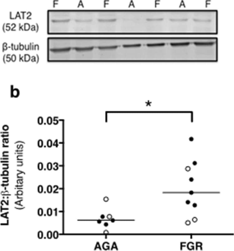 Anti-LAT2 antibody(AB75610)