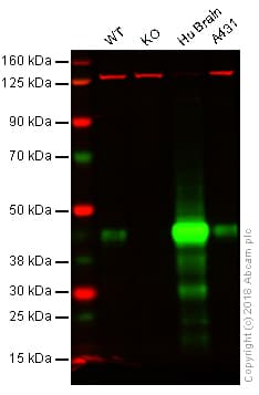 Anti-Glutamine Synthetase antibody [EPR16661](AB197024)