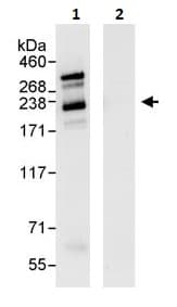 Anti-SMARCA2 / BRM antibody(AB264163)