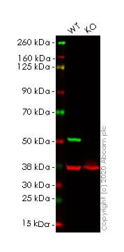 Anti-beta III Tubulin antibody [EP1569Y] - Neuronal Marker(AB52623)