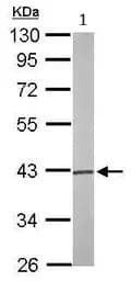 Anti-Phosphoserine Aminotransferase antibody(AB96136)