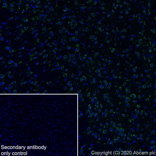 Anti-SCA2 antibody [EPR23630-49] - BSA and Azide free(ab275752)