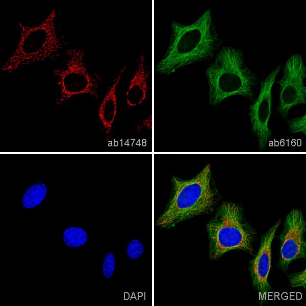 Anti-ATP5A antibody [15H4C4] - Mitochondrial Marker(AB14748)