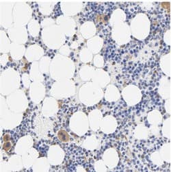 Tagln2 Antibody Ab121146  Immunohistochemistry Formalin Pfa Fixed Paraffin Embedded Sections Img28311