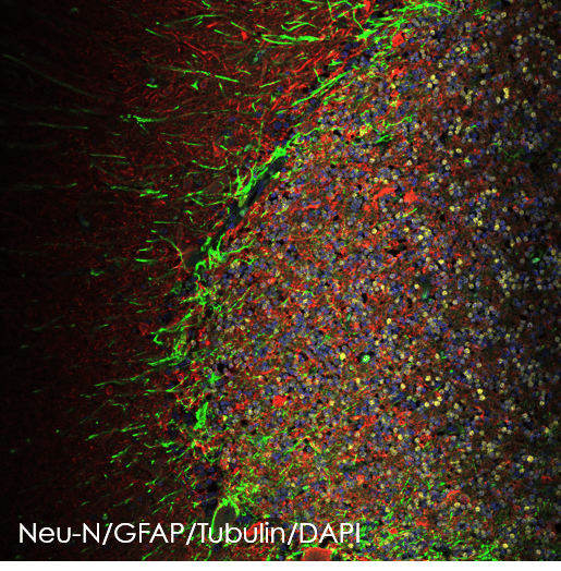 Anti-beta III Tubulin antibody [EP1569Y] - Neuronal Marker(AB52623)