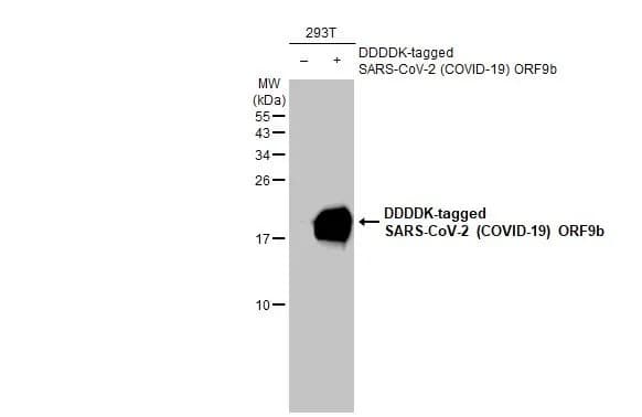 Anti-SARS CoV 2 (COVID 19) ORF9b antibody [HL1918](ab308403)