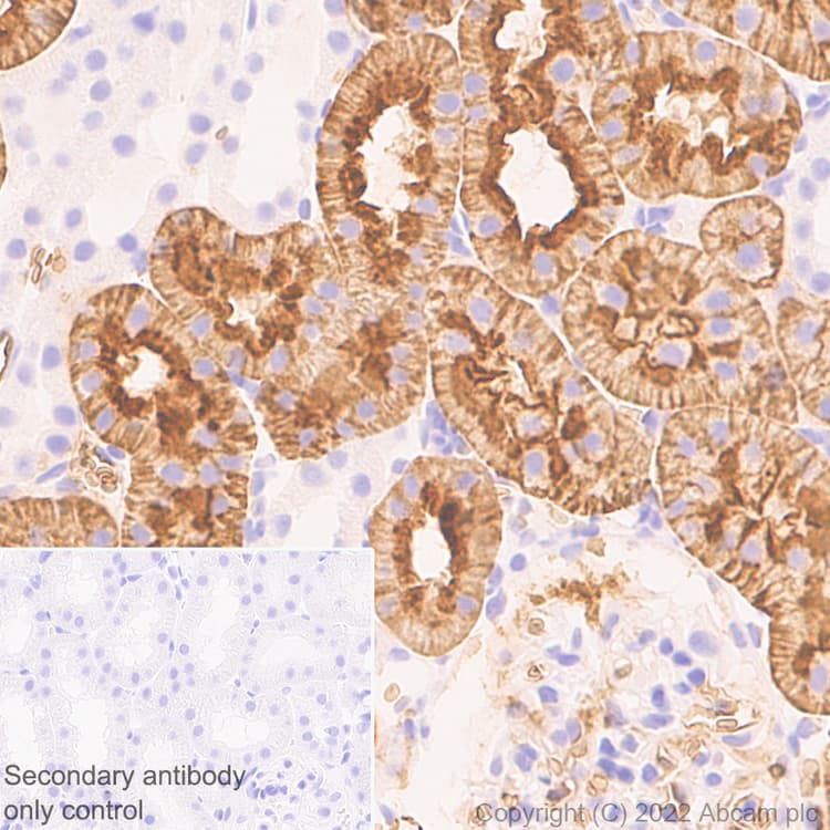 Aquaporin 1 Antibody Epr26554 46 Bsa And Azide Free Ab300464  Immunohistochemistry Formalin Pfa Fixed Paraffin Embedded Sections Img400424