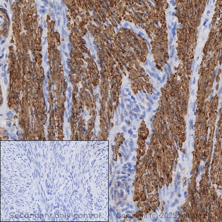 Anti-Calponin 1 antibody [EP798Y](AB46794)