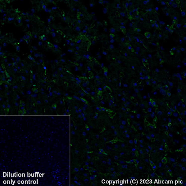 Alexa Fluor® 488 Anti-Mannose Receptor antibody [EPR22489-7](AB313398)