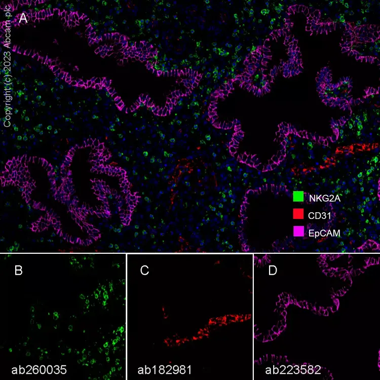 Anti-CD31 antibody [EPR17259](AB182981)