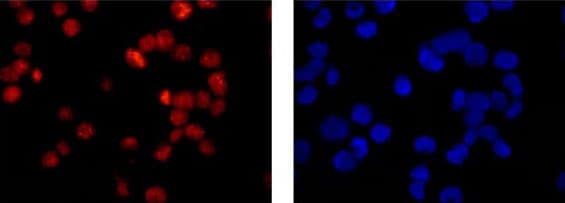 Anti-POLD1 antibody [EPR15118](AB186407)