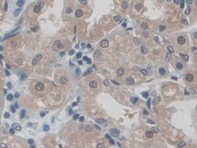 Cd300c Antibody Ab232789  Immunohistochemistry Formalin Pfa Fixed Paraffin Embedded Sections Img68965
