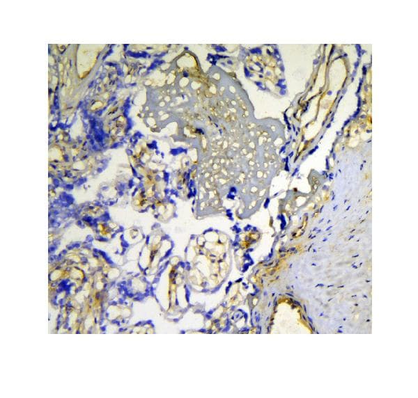 Galectin 1 Antibody Ab112525  Immunohistochemistry Frozen Sections Img16412