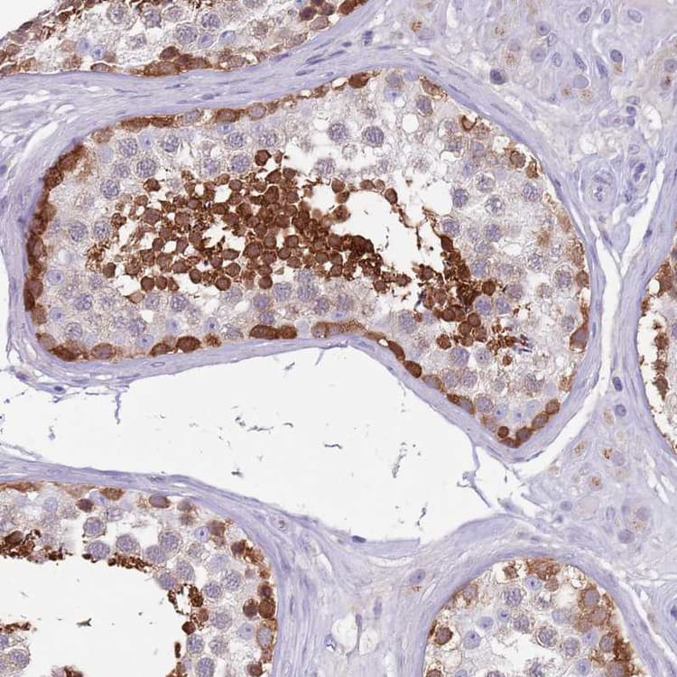 Ddhd1 Antibody Ab151078  Immunohistochemistry Formalin Pfa Fixed Paraffin Embedded Sections Img114990