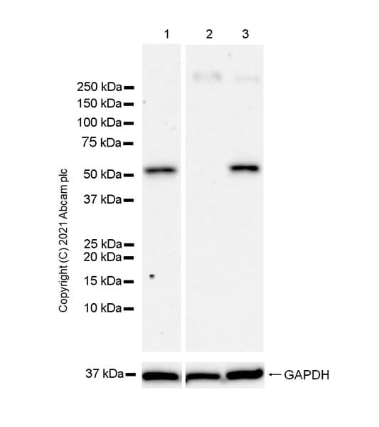 Gaba A Receptor Gamma 2 Gabrg2 Antibody Epr25325 5 Ab288564  Western Blot Img171852