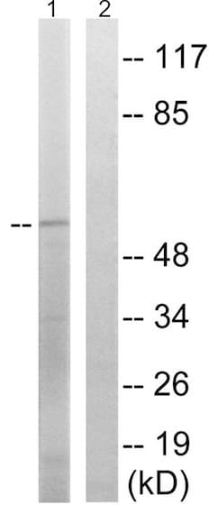 Anti-SPAK (phospho S309) antibody(AB192798)