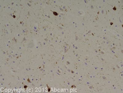 Anti-Tau (phospho T231) antibody [EPR2488] - BSA and Azide free(AB156624)