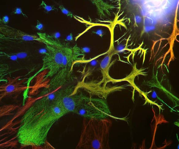 Anti-Vimentin antibody(AB24525)