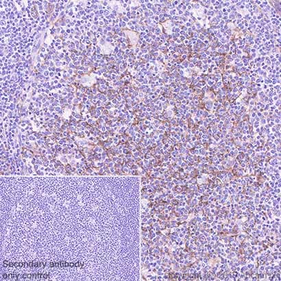 Anti-CD14 antibody [SP192](AB183322)