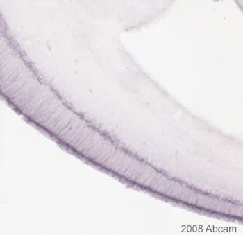 Anti-MAP2 antibody [AP-20](AB11268)