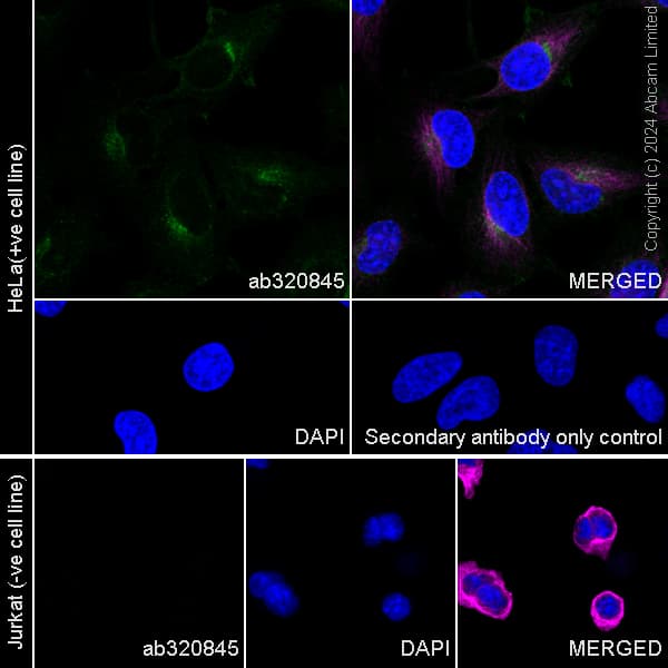 Ltbr Antibody Rm2069 Ab320845  Immunocytochemistry Immunofluorescence Img435562