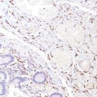 Anti-CD14 antibody [SP192](AB183322)