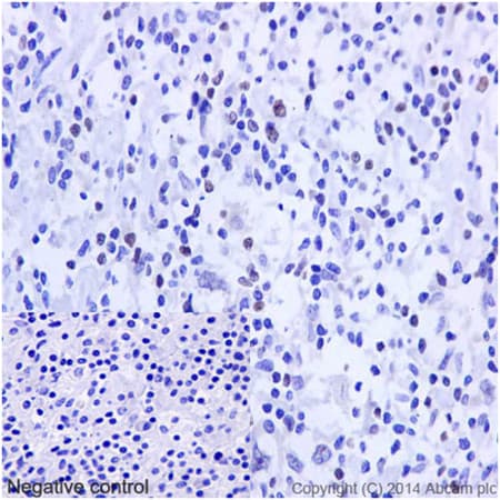Foxp3 Antibody Epr15038 69 Ab191416  Immunohistochemistry Formalin Pfa Fixed Paraffin Embedded Sections Img119396