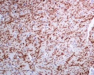 Anti-Myelin Basic Protein antibody [EPR6652](AB133620)