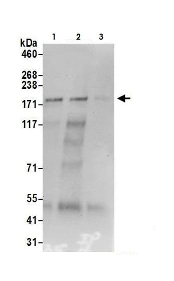 Kat13a Src1 Antibody Ab10308  Immunoprecipitation Img52177