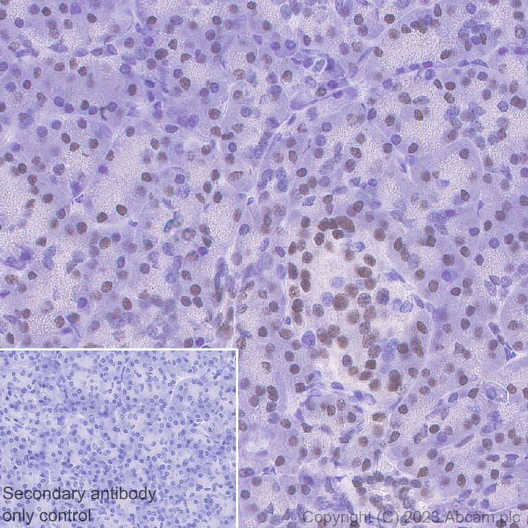 Hnf1 Alpha Antibody Rm1094 Bsa And Azide Free Ab316871  Immunohistochemistry Formalin Pfa Fixed Paraffin Embedded Sections Img428282