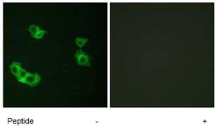 Parathyroid Hormone Receptor 1 Pth1r Antibody Ab75150  Immunocytochemistry Immunofluorescence Img63036