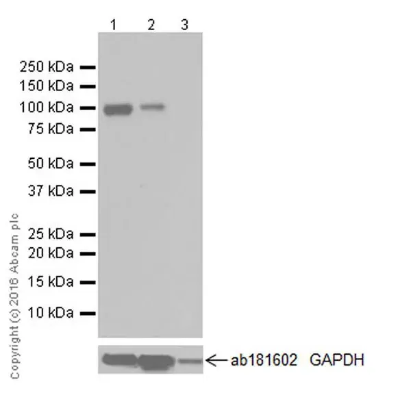 Anti-Fibroblast activation protein, alpha antibody [EPR20021](AB207178)
